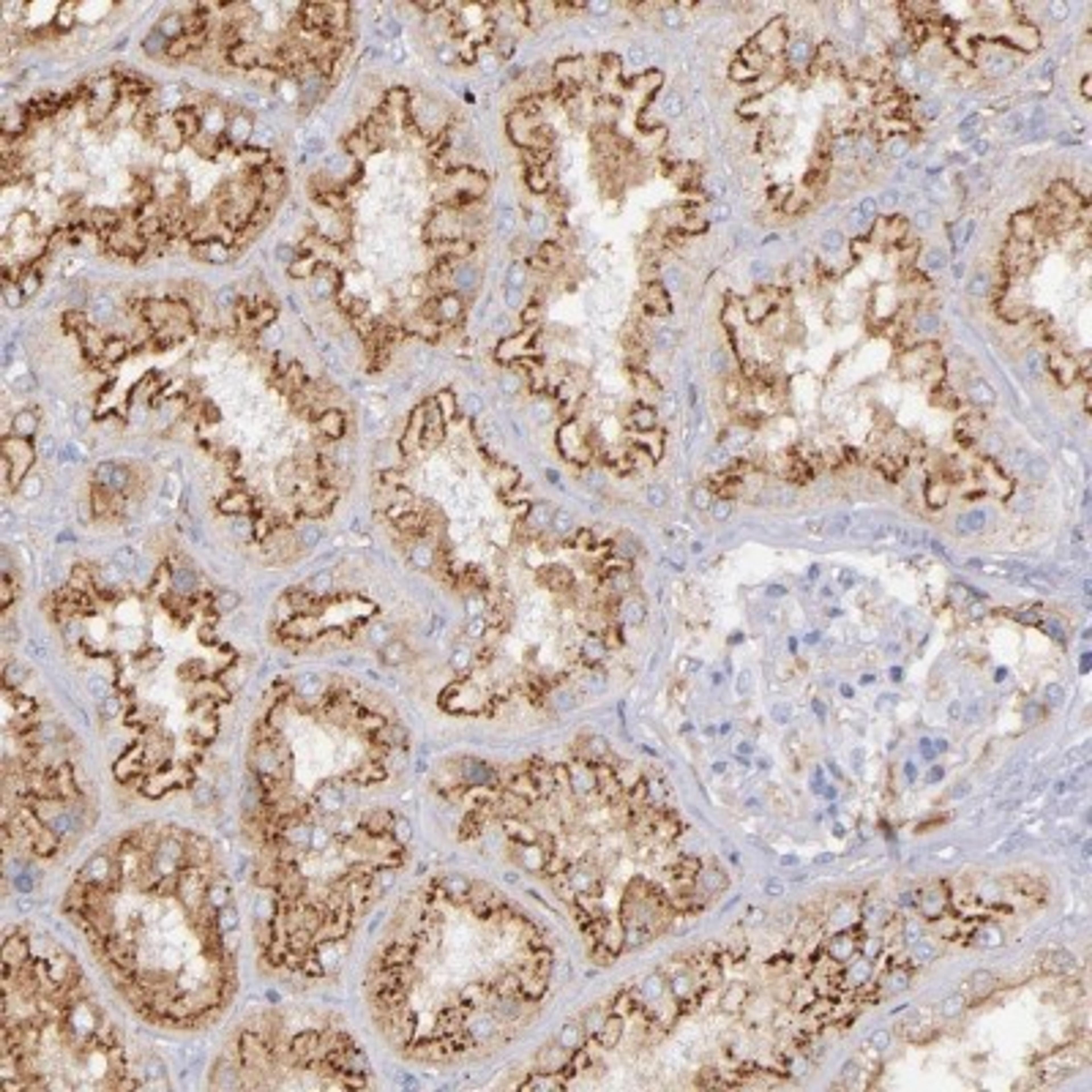 Immunohistochemistry-Paraffin: LMW Kininogen Antibody [NBP1-89993] - Staining of human kidney shows distinct membranous positivity in cells in tubules.