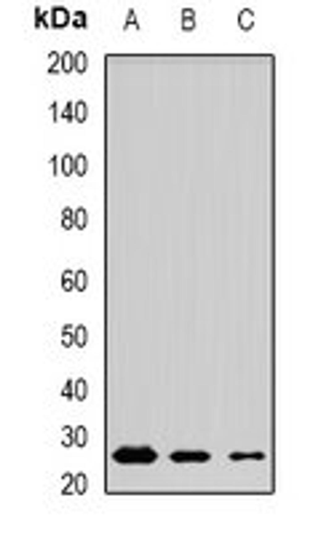 Western blot analysis of mouse testis (Lane1), mouse brain (Lane2), rat lung (Lane3) whole cell lysates using MSRB3 antibody