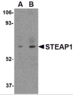 Western blot analysis of STEAP1 in human spleen tissue lysate with STEAP1 antibody at (A) 1 and (B) 2 &#956;g/mL.