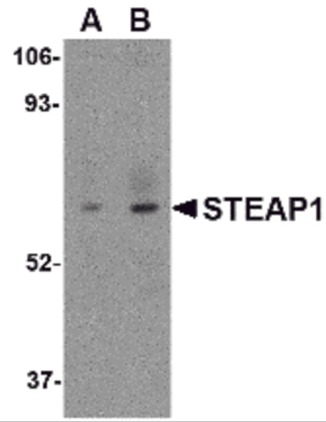 Western blot analysis of STEAP1 in human spleen tissue lysate with STEAP1 antibody at (A) 1 and (B) 2 μg/mL.