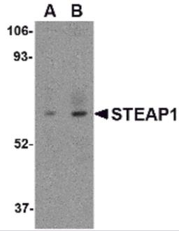 Western blot analysis of STEAP1 in human spleen tissue lysate with STEAP1 antibody at (A) 1 and (B) 2 μg/mL.