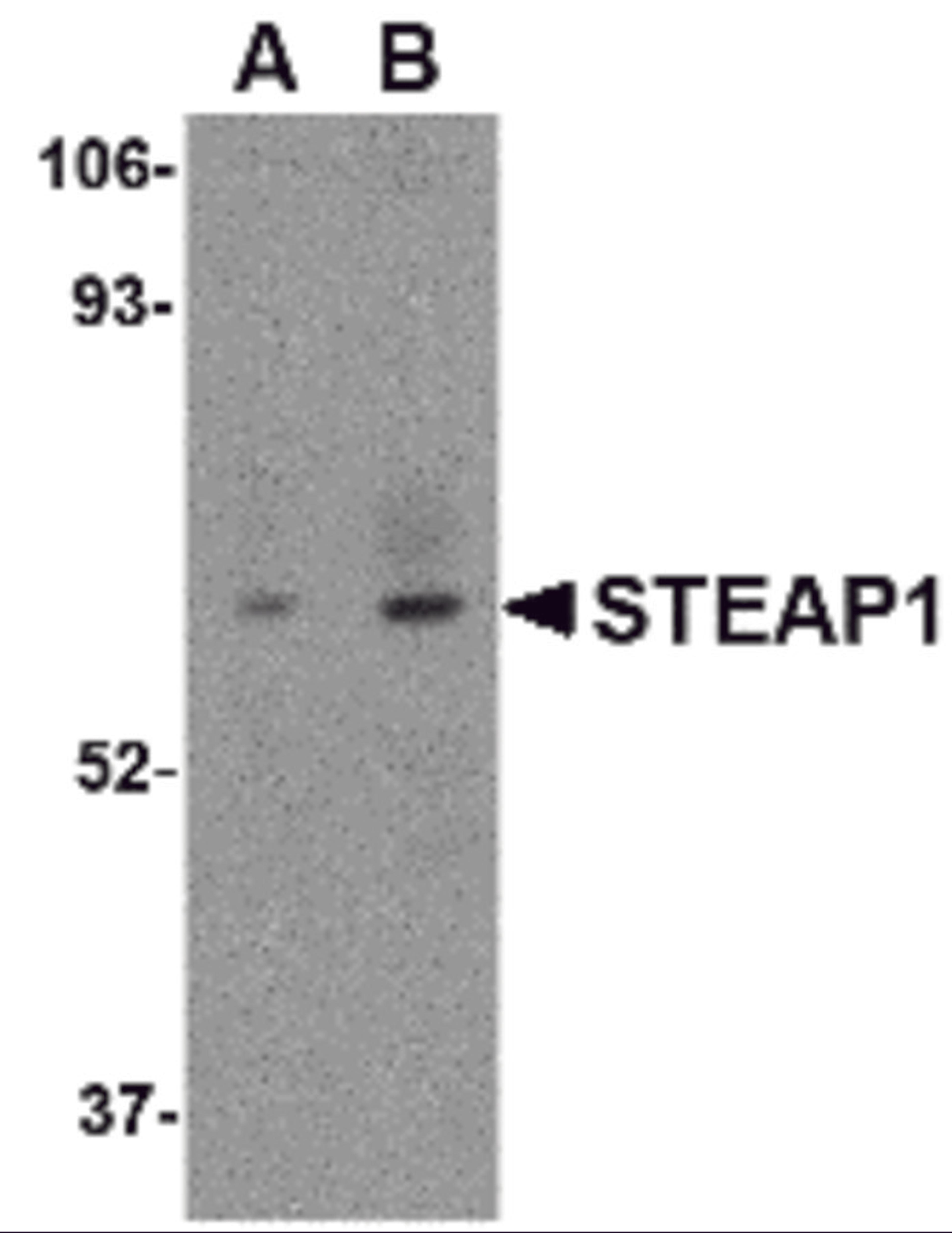Western blot analysis of STEAP1 in human spleen tissue lysate with STEAP1 antibody at (A) 1 and (B) 2 μg/mL.