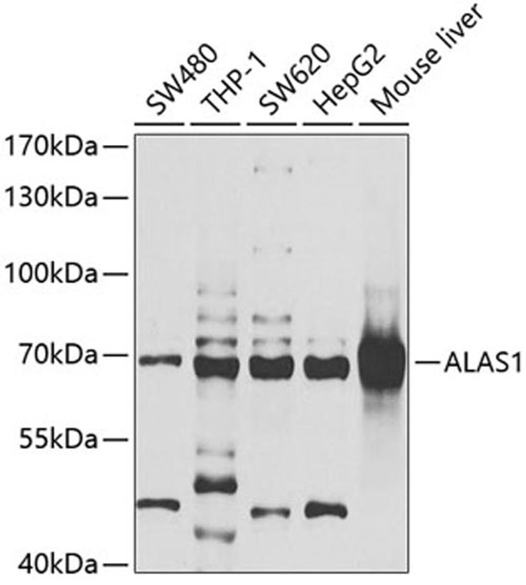 Western blot - ALAS1 antibody (A6521)