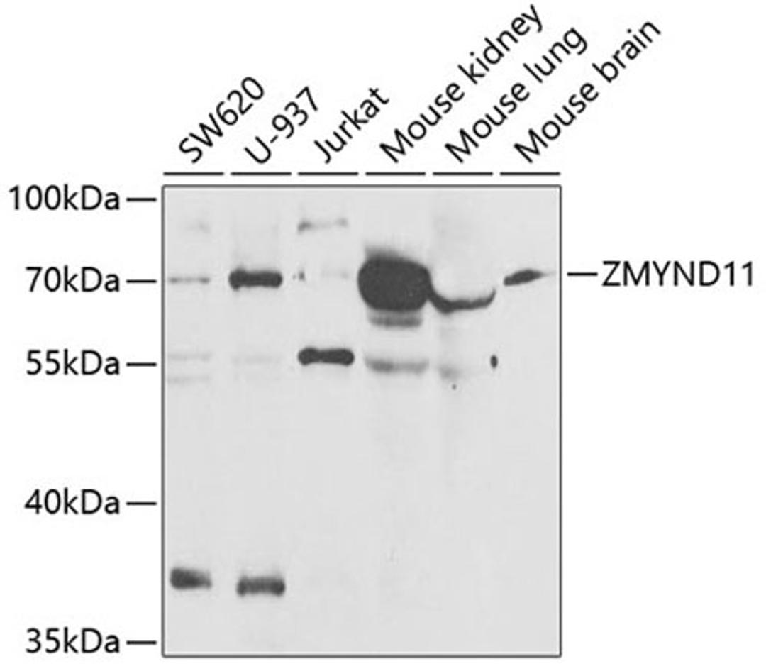 Western blot - ZMYND11 antibody (A6327)