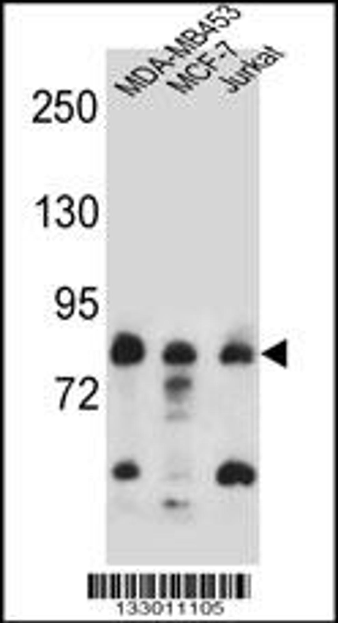 Western blot analysis in MDA-MB453,MCF-7,Jurkat cell line lysates (35ug/lane).