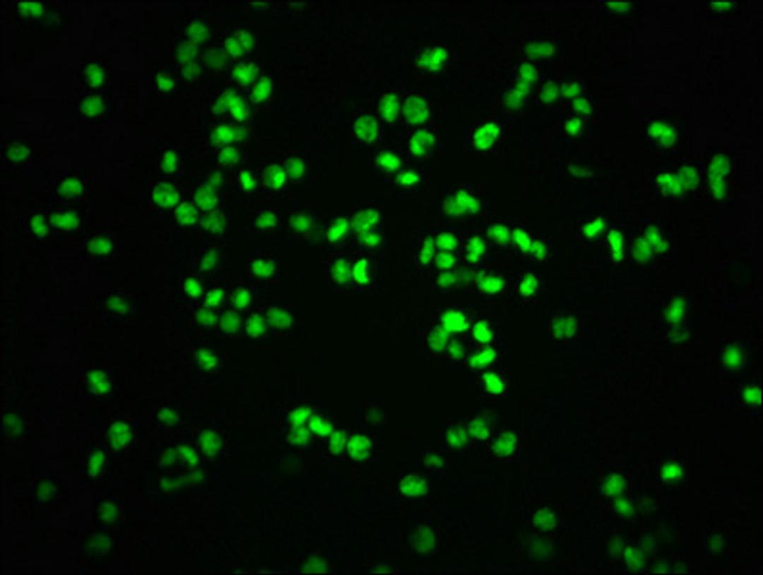 Immunofluorescence staining of K562 cells with CSB-RA019386A807phHU at 1:100,counter-stained with DAPI. The cells were fixed in 4% formaldehyde, permeabilized using 0.2% Triton X-100 and blocked in 10% normal Goat Serum. The cells were then incubated with the antibody overnight at 4℃. The secondary antibody was Alexa Fluor 488-congugated AffiniPure Goat Anti-Rabbit IgG (H+L).