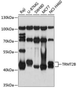 Western blot - TRMT2B antibody (A3509)
