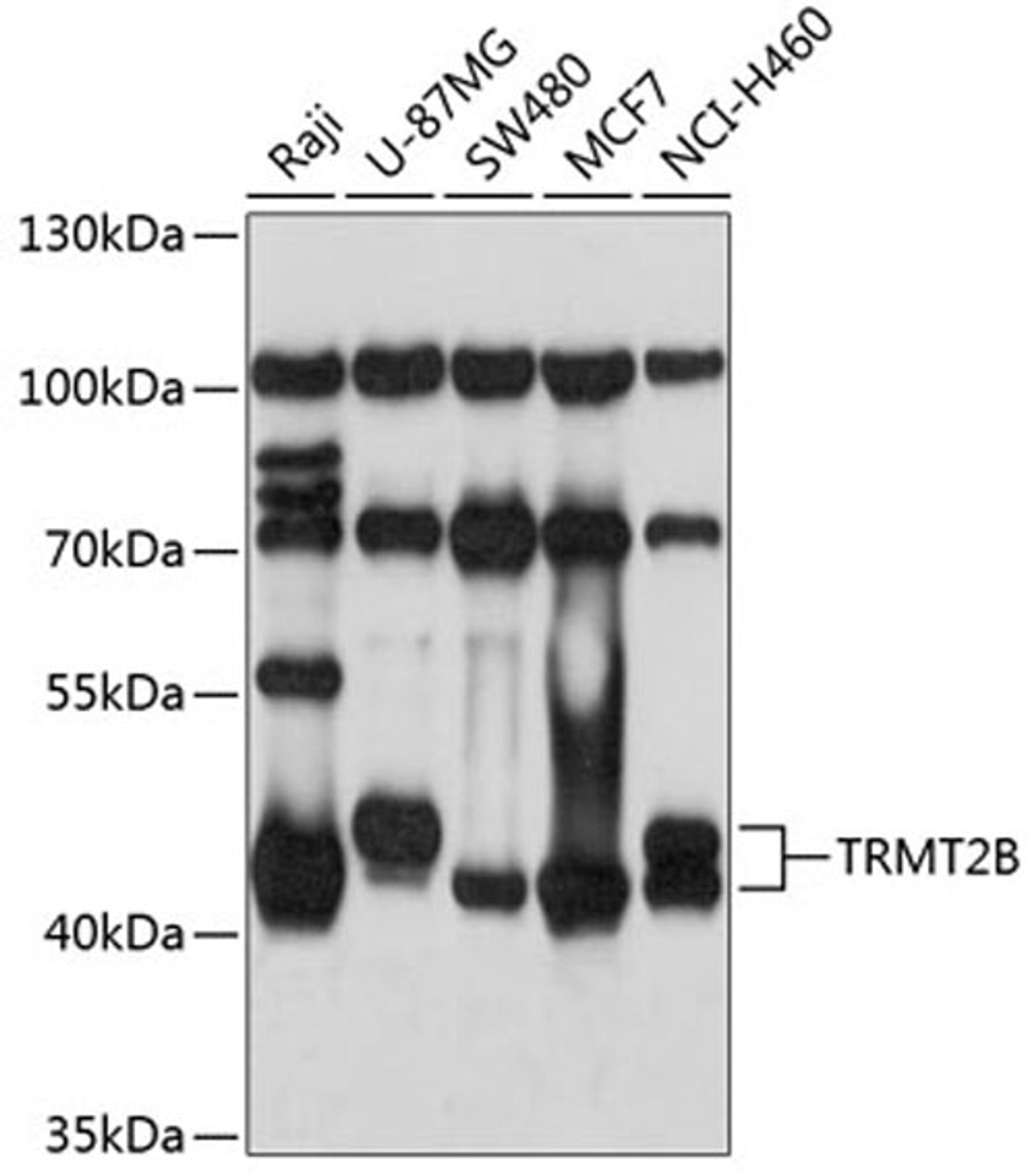 Western blot - TRMT2B antibody (A3509)