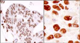 Detection of human and mouse hnRNP-K by immunohistochemistry.