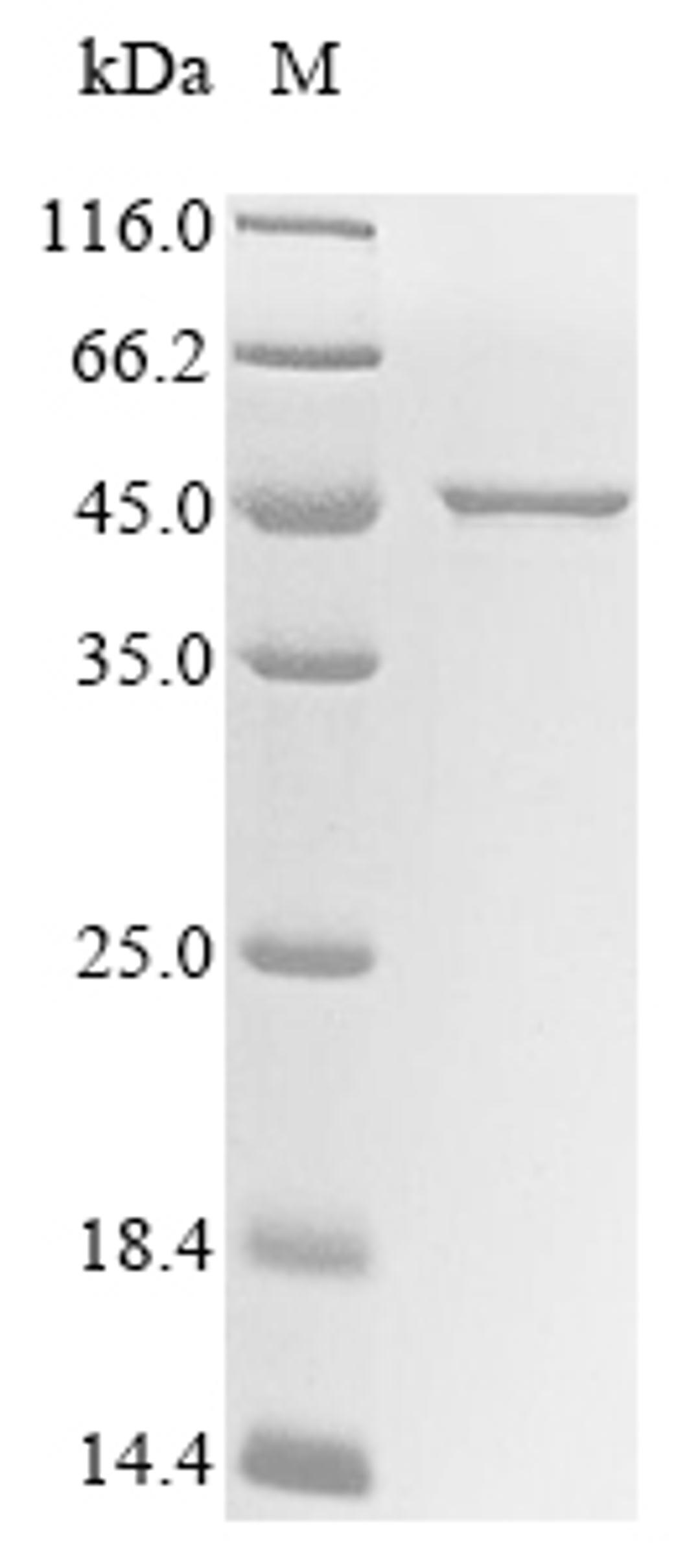 (Tris-Glycine gel) Discontinuous SDS-PAGE (reduced) with 5% enrichment gel and 15% separation gel.