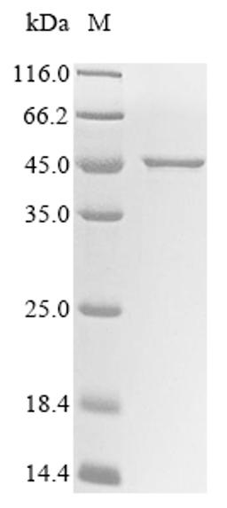 (Tris-Glycine gel) Discontinuous SDS-PAGE (reduced) with 5% enrichment gel and 15% separation gel.