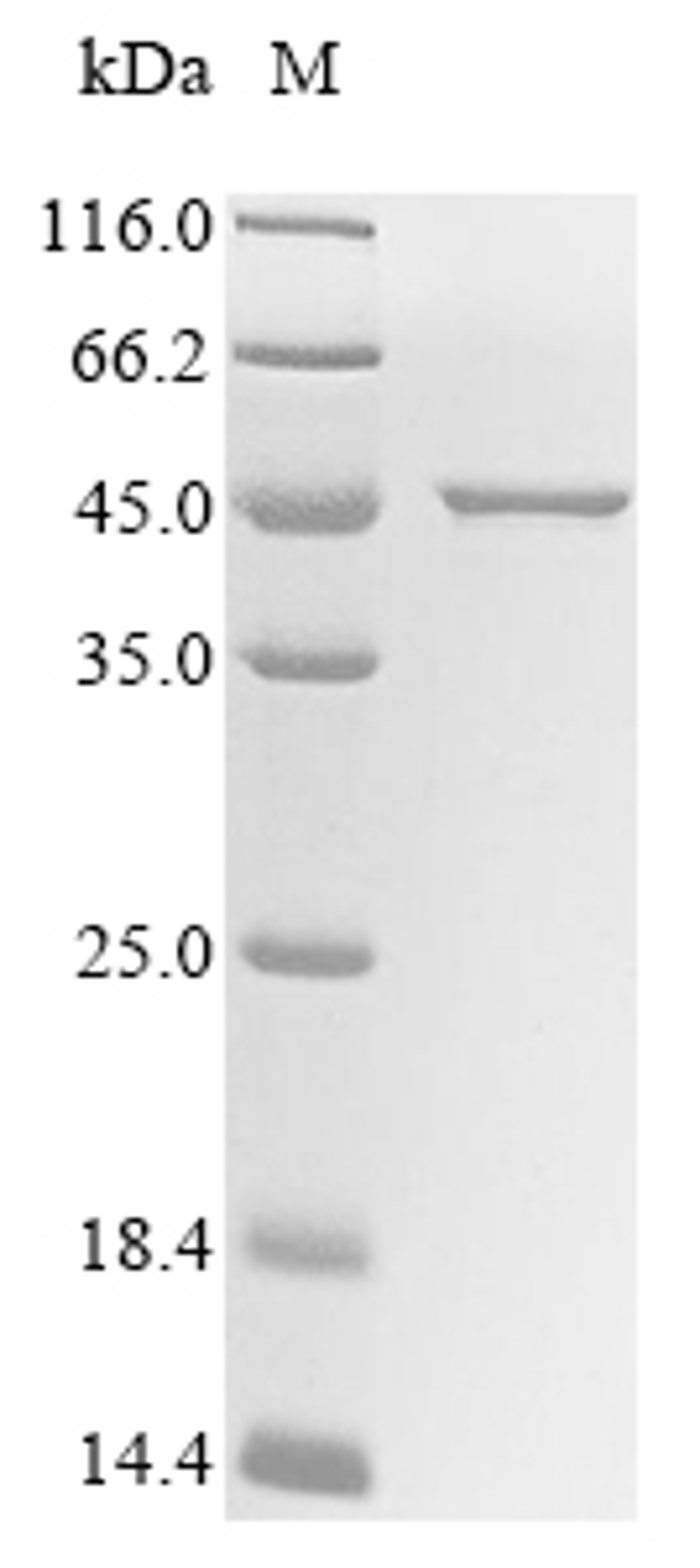 (Tris-Glycine gel) Discontinuous SDS-PAGE (reduced) with 5% enrichment gel and 15% separation gel.