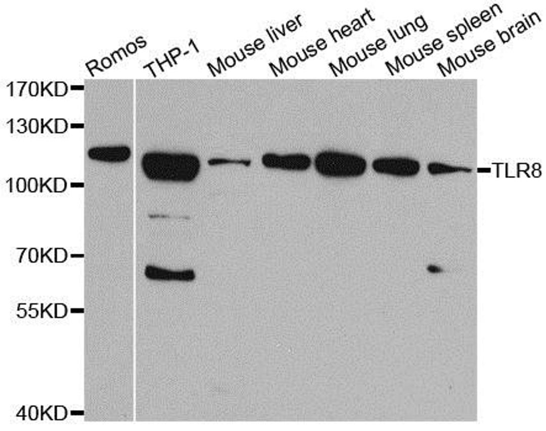 Western blot analysis of extracts of various cell lines using TLR8 antibody