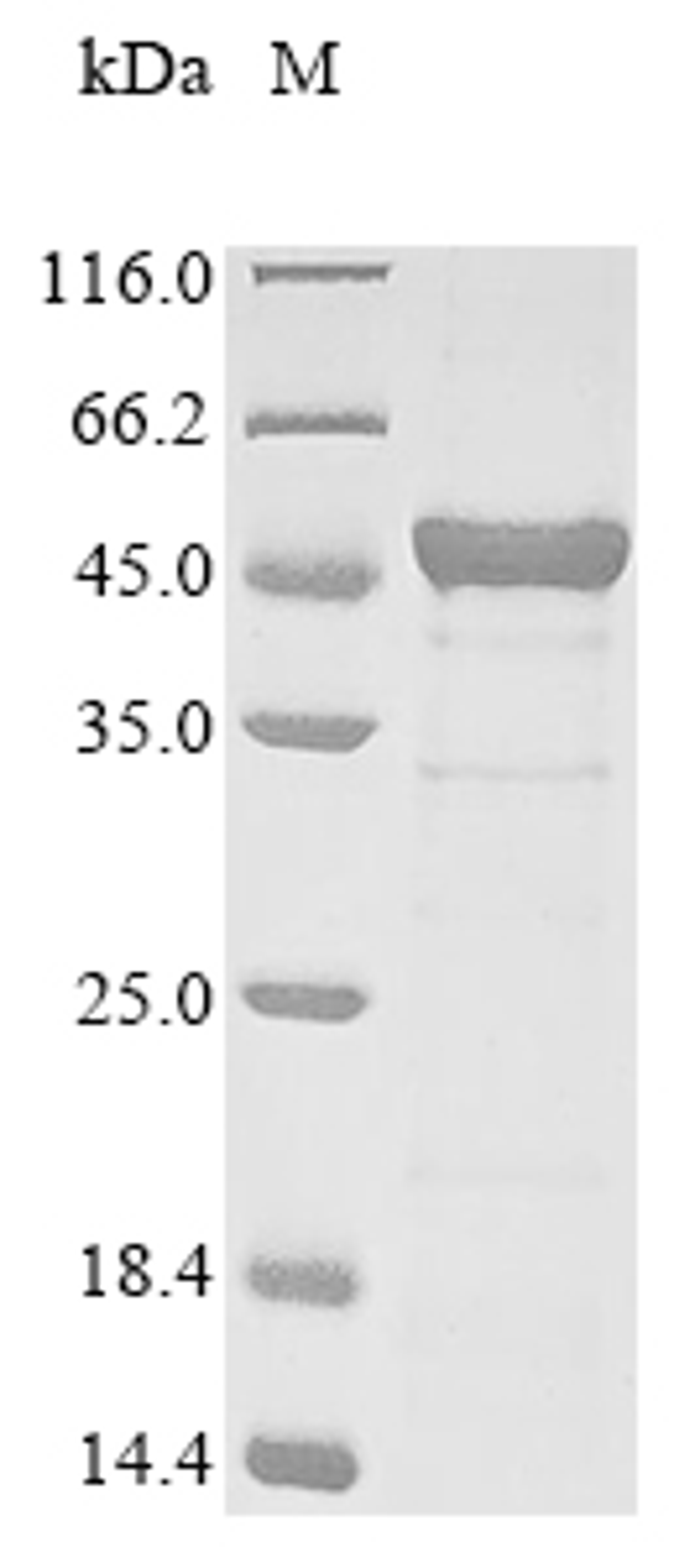 (Tris-Glycine gel) Discontinuous SDS-PAGE (reduced) with 5% enrichment gel and 15% separation gel.