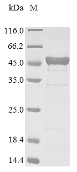 (Tris-Glycine gel) Discontinuous SDS-PAGE (reduced) with 5% enrichment gel and 15% separation gel.