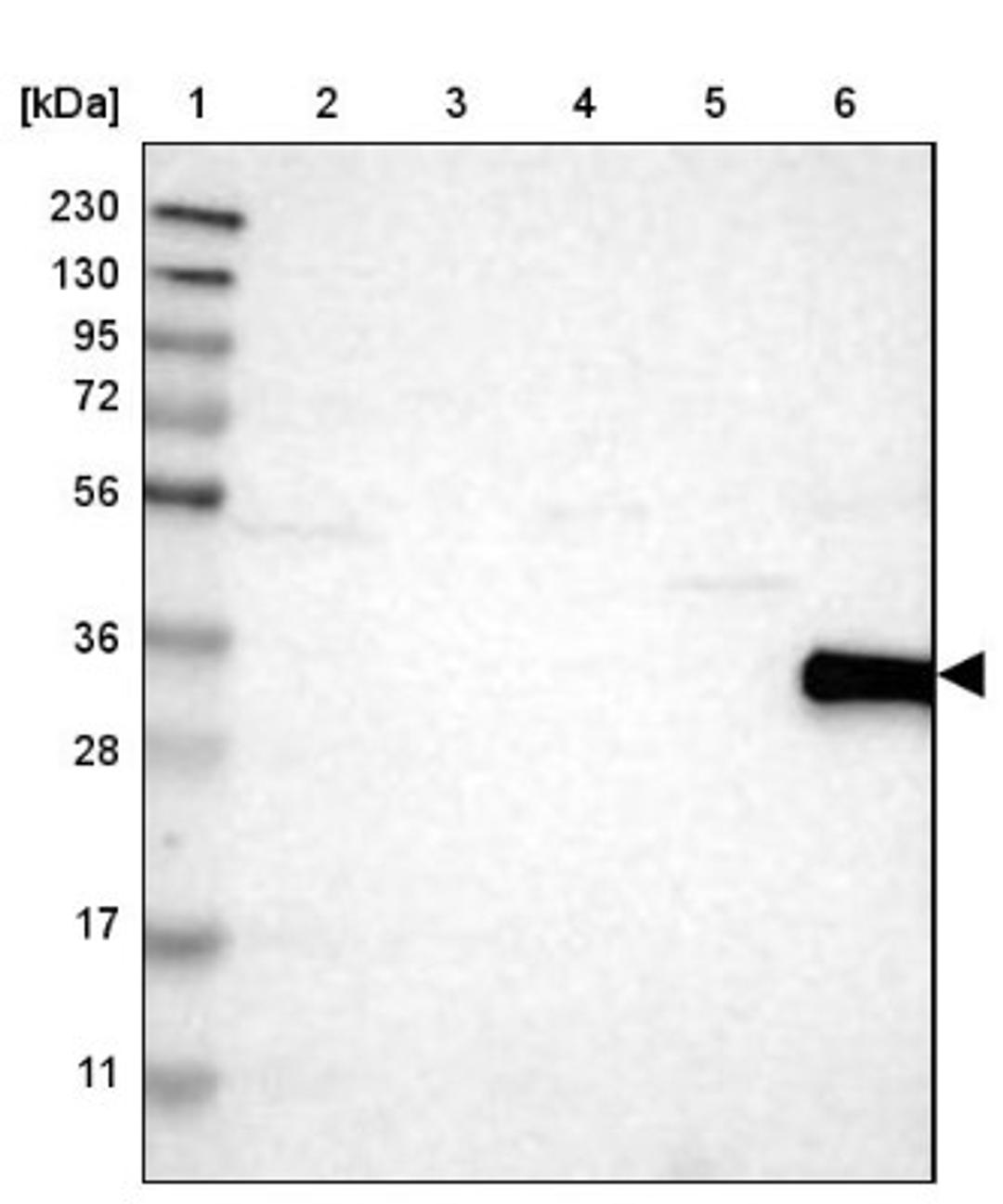 Western Blot: CD226 Antibody [NBP1-85001] - Lane 1: Marker [kDa] 230, 130, 95, 72, 56, 36, 28, 17, 11<br/>Lane 2: Human cell line RT-4<br/>Lane 3: Human cell line U-251MG sp<br/>Lane 4: Human plasma (IgG/HSA depleted)<br/>Lane 5: Human liver tissue<br/>Lane 6: Human tonsil tissue