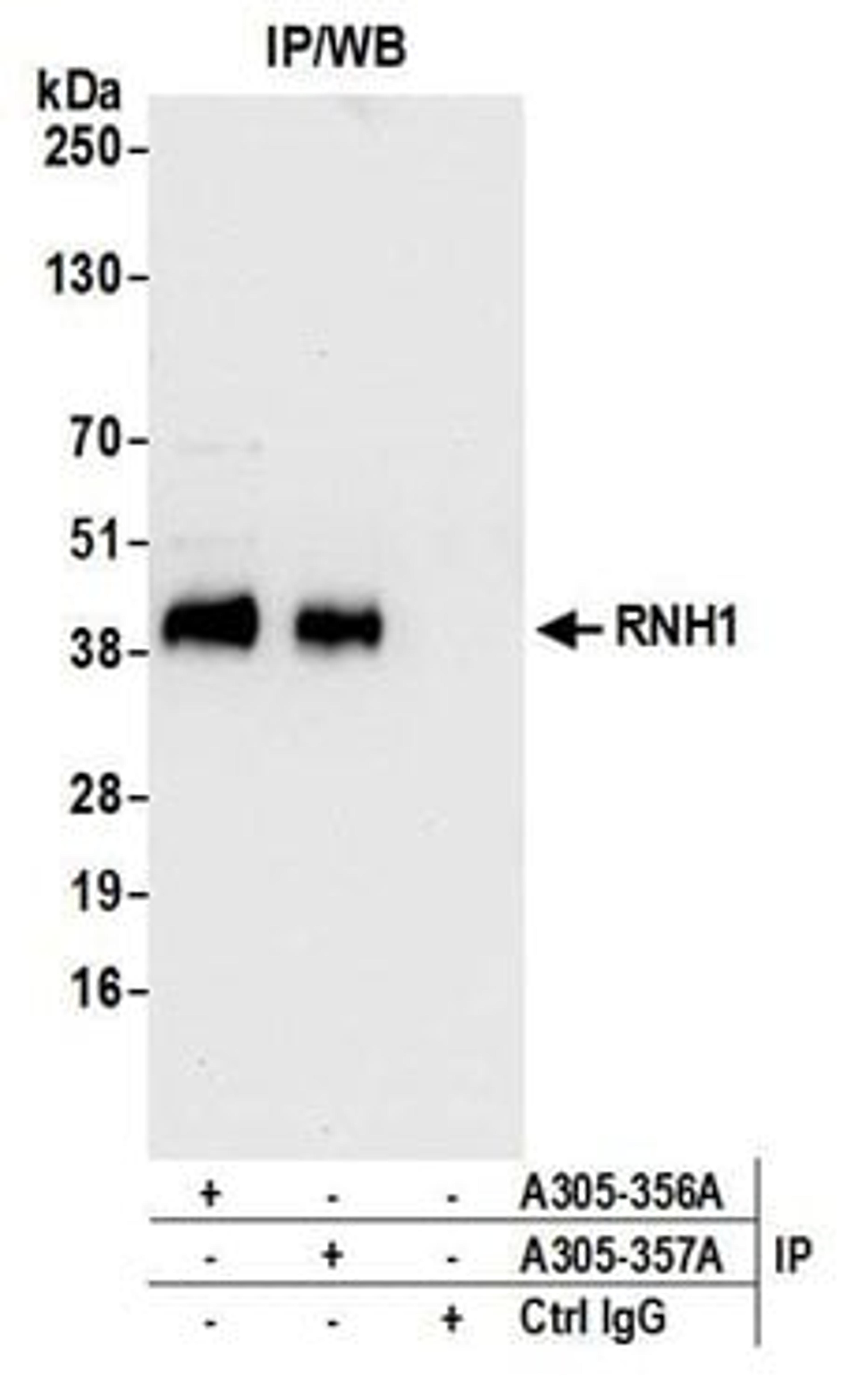 Detection of human RNH1 by western blot of immunoprecipitates.