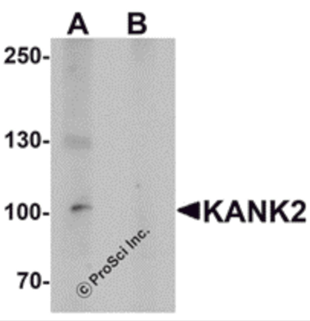 Western blot analysis of KANK2 in mouse brain tissue lysate with KANK2 antibody at 1 μg/mL in (A) the absence and (B) the presence of blocking peptide.