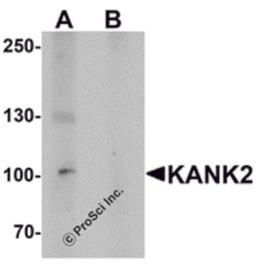 Western blot analysis of KANK2 in mouse brain tissue lysate with KANK2 antibody at 1 μg/mL in (A) the absence and (B) the presence of blocking peptide.