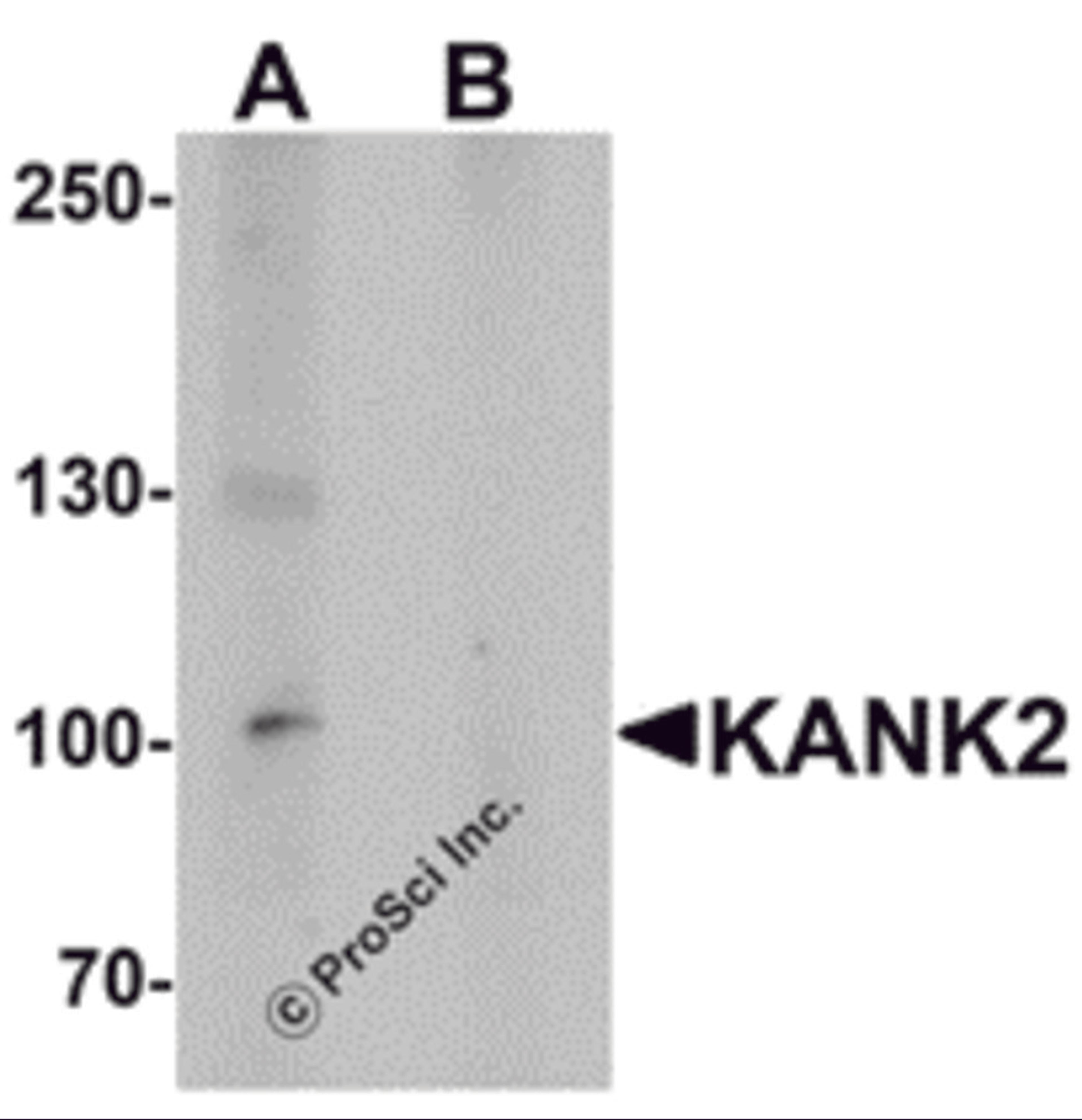 Western blot analysis of KANK2 in mouse brain tissue lysate with KANK2 antibody at 1 μg/mL in (A) the absence and (B) the presence of blocking peptide.
