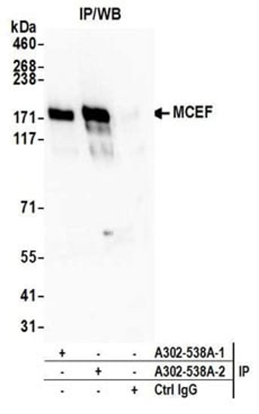 Detection of Human MCEF by Western Blot of Immunoprecipitates.