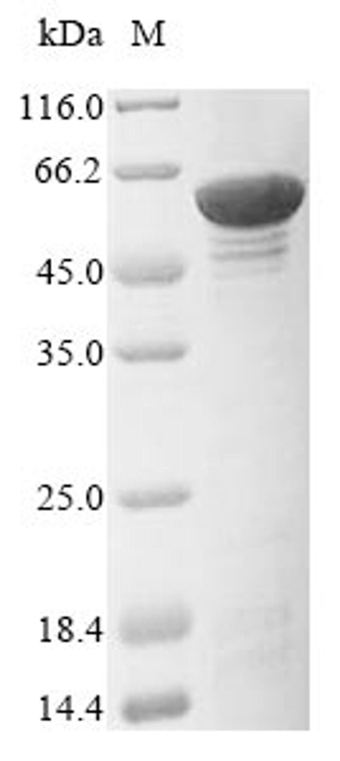 (Tris-Glycine gel) Discontinuous SDS-PAGE (reduced) with 5% enrichment gel and 15% separation gel.