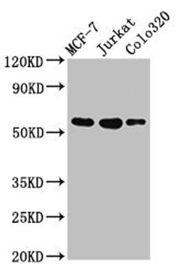Western Blot. Positive WB detected in: MCF-7 whole cell lysate, Jurkat whole cell lysate, Colo320 whole cell lysate. All lanes: IRX4 antibody at 3µg/ml. Secondary. Goat polyclonal to rabbit IgG at 1/50000 dilution. Predicted band size: 55, 58 kDa. Observed band size: 55 kDa