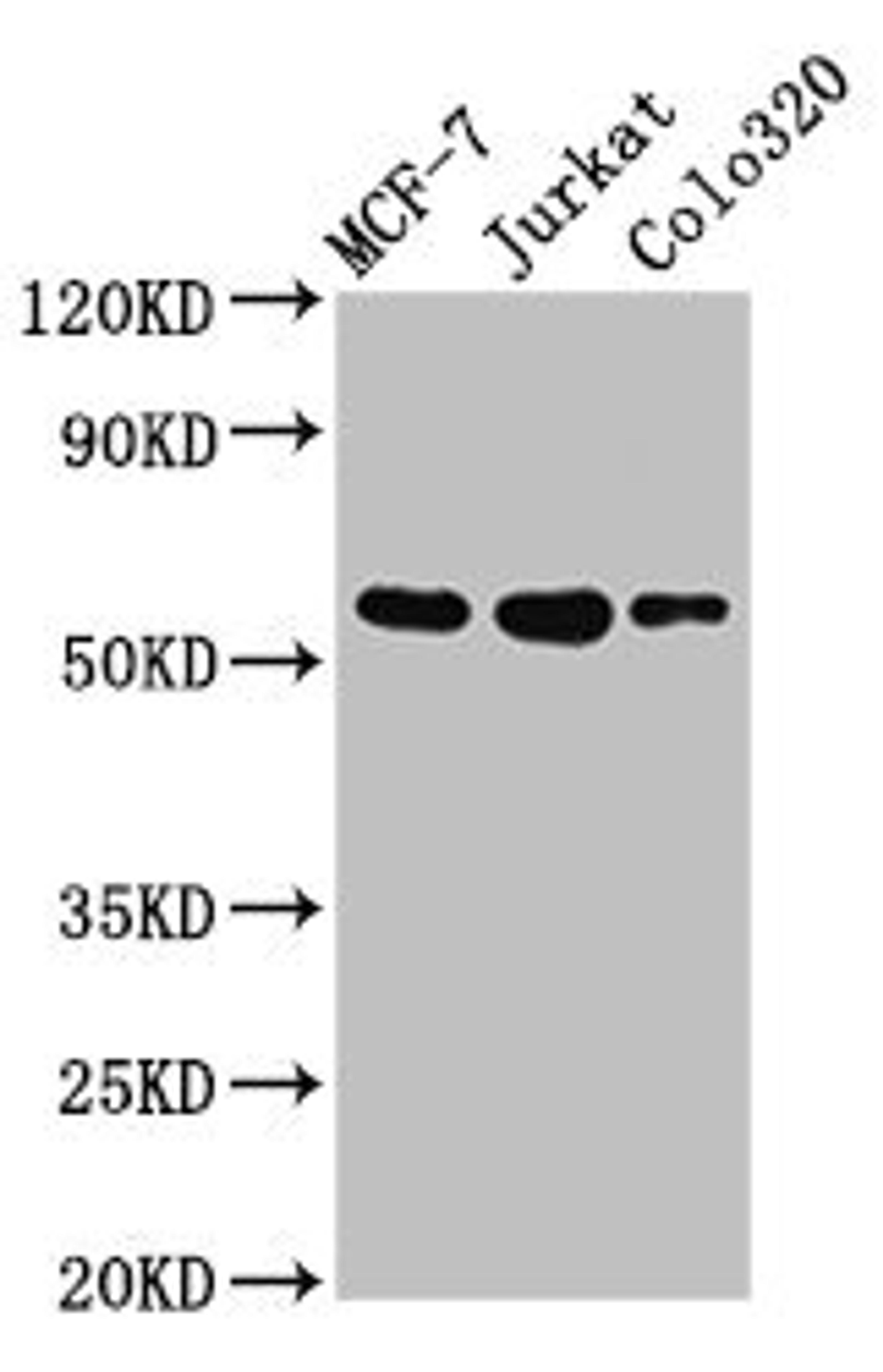 Western Blot. Positive WB detected in: MCF-7 whole cell lysate, Jurkat whole cell lysate, Colo320 whole cell lysate. All lanes: IRX4 antibody at 3µg/ml. Secondary. Goat polyclonal to rabbit IgG at 1/50000 dilution. Predicted band size: 55, 58 kDa. Observed band size: 55 kDa