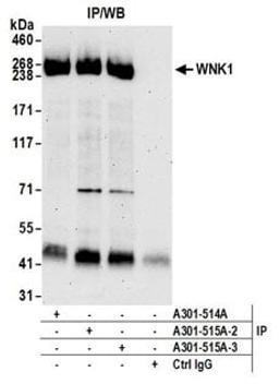 Detection of human WNK1 by western blot of immunoprecipitates.