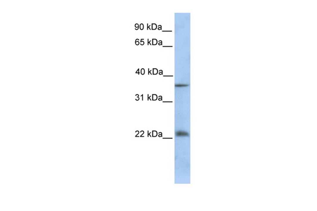 Antibody used in WB on Human Muscle at 0.2-1 ug/ml.