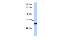 Antibody used in WB on Human MCF-7 at 0.2-1 ug/ml.