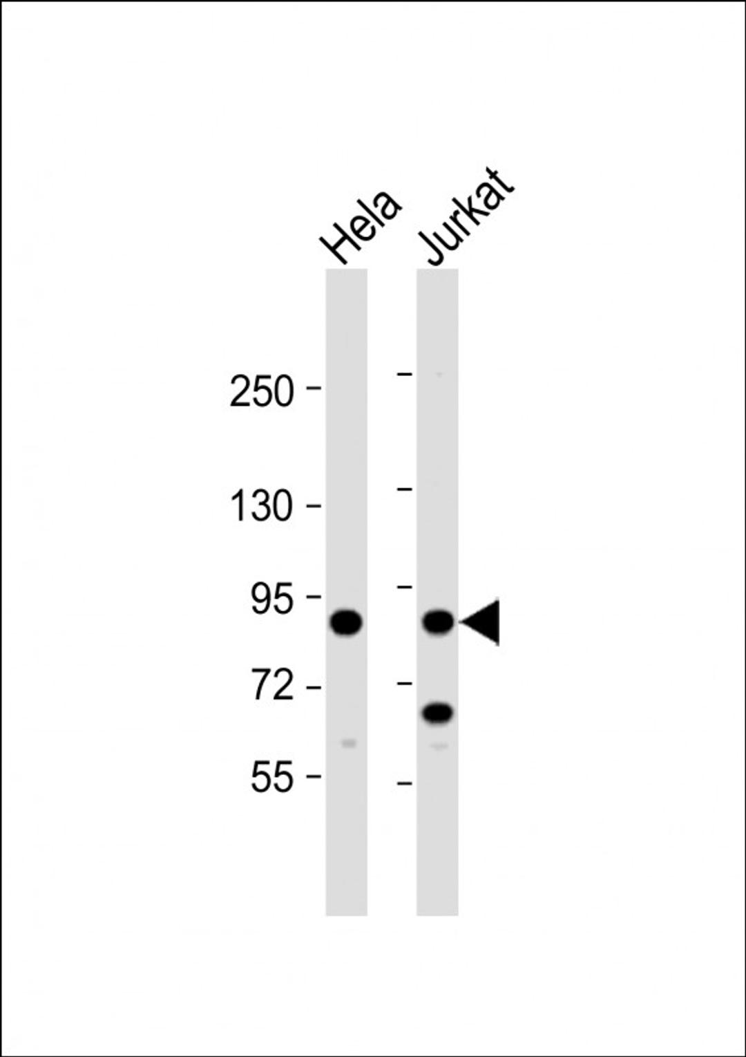 Western Blot at 1:8000 dilution Lane 1: Hela whole cell lysate Lane 2: Jurkat whole cell lysate Lysates/proteins at 20 ug per lane.