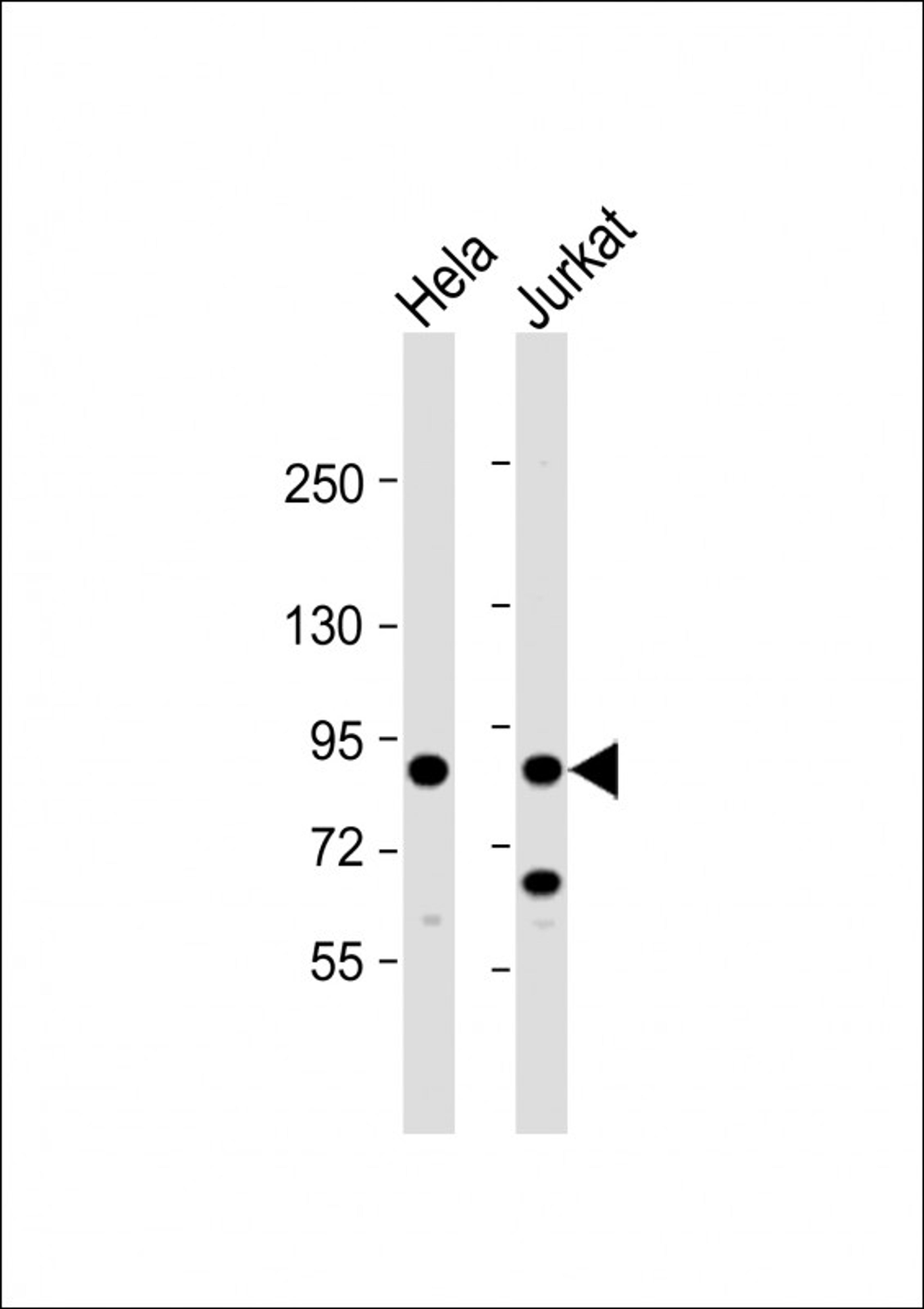 Western Blot at 1:8000 dilution Lane 1: Hela whole cell lysate Lane 2: Jurkat whole cell lysate Lysates/proteins at 20 ug per lane.