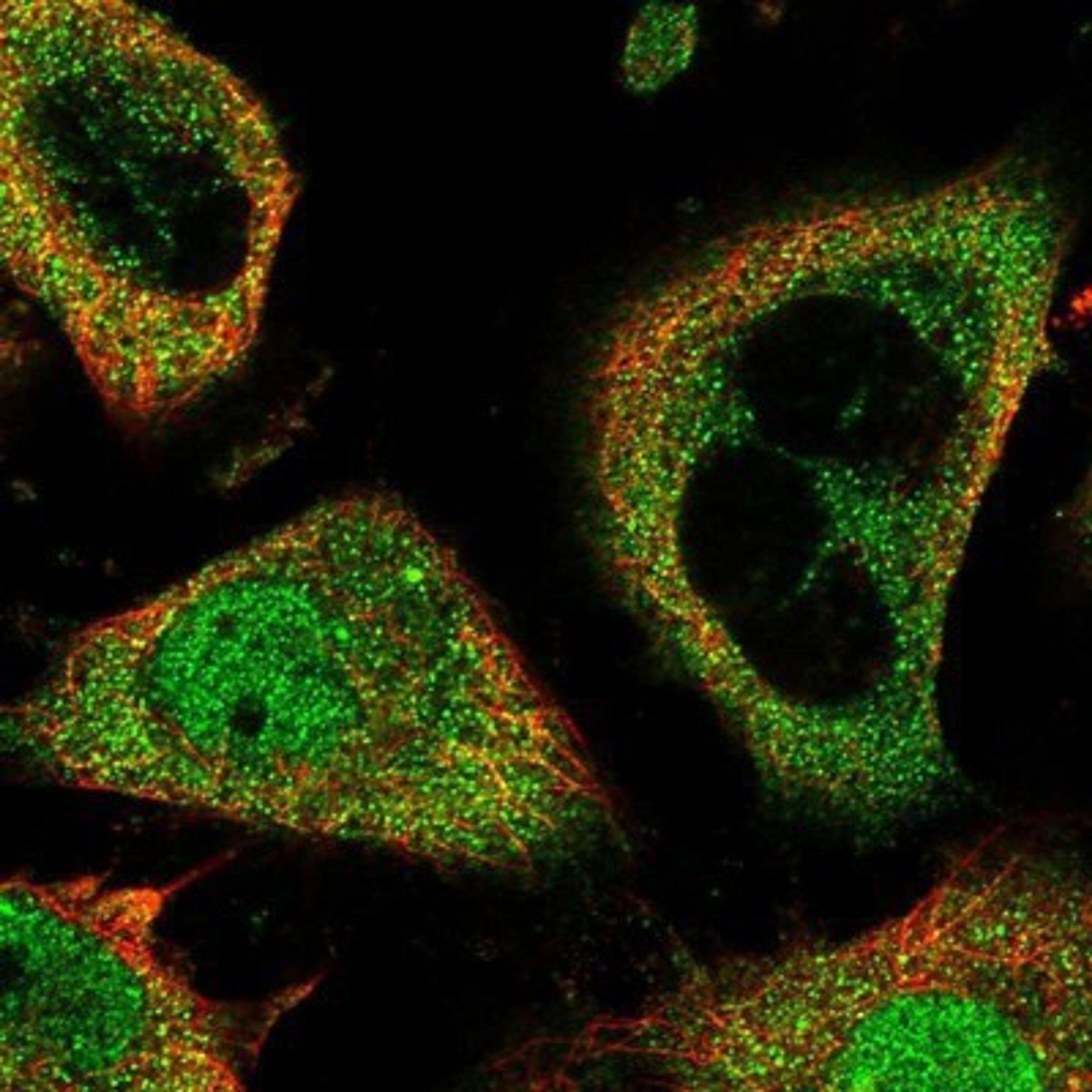 Immunocytochemistry/Immunofluorescence: PPAN Antibody [NBP1-88525] - Staining of human cell line U-251 MG shows positivity in nucleus but not nucleoli & cytoplasm.