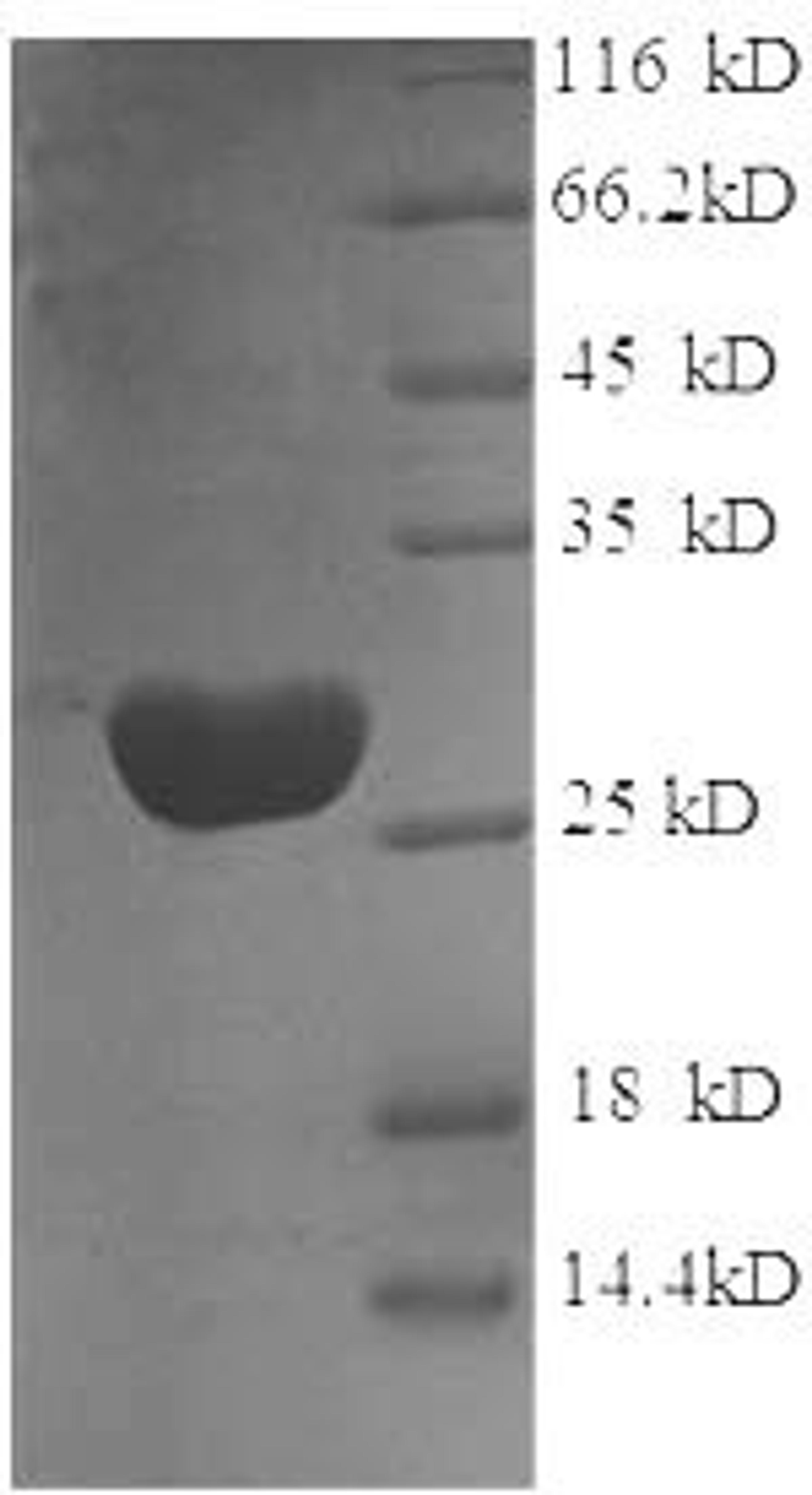 (Tris-Glycine gel) Discontinuous SDS-PAGE (reduced) with 5% enrichment gel and 15% separation gel.