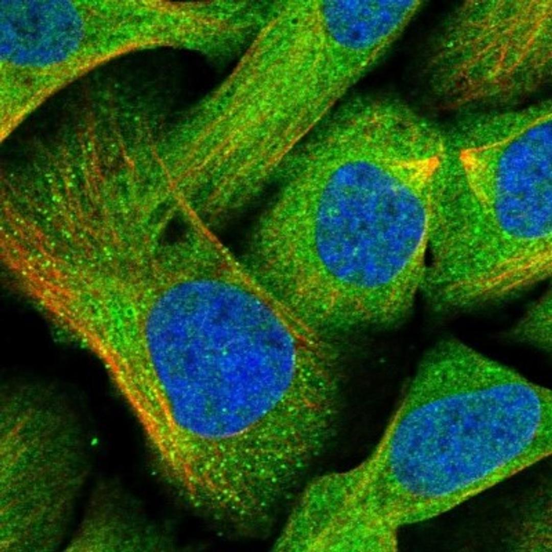 Immunocytochemistry/Immunofluorescence: EXOC6 Antibody [NBP1-85031] - Staining of human cell line U-2 OS shows positivity in cytoplasm, vesicles & centrosome.