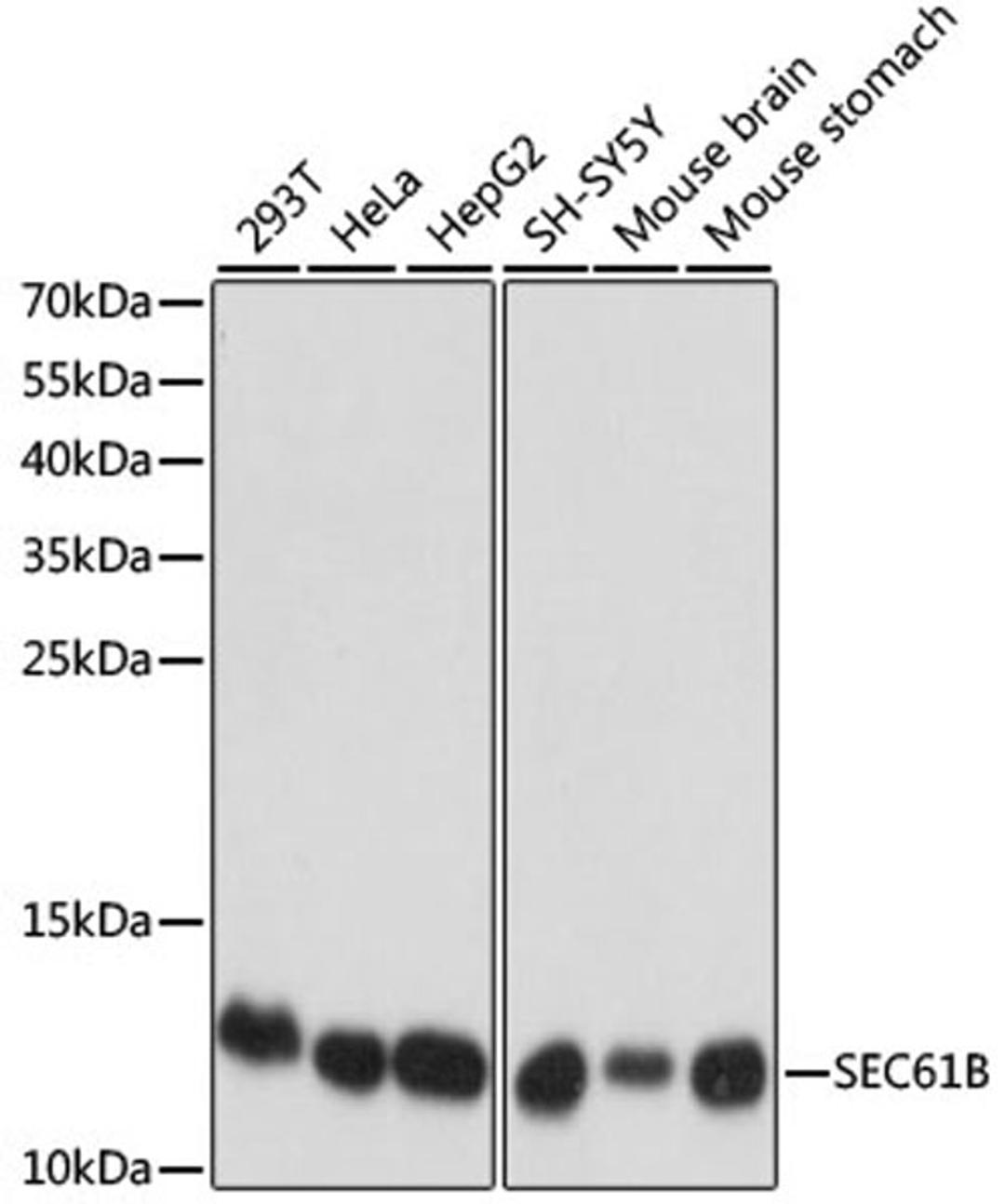 Western blot - SEC61B antibody (A15788)