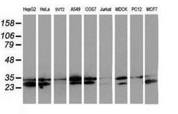 Western Blot: HDHD1A Antibody (7A2) [NBP2-00487] Analysis of extracts (35ug) from 9 different cell lines by using anti-HDHD1A monoclonal antibody.