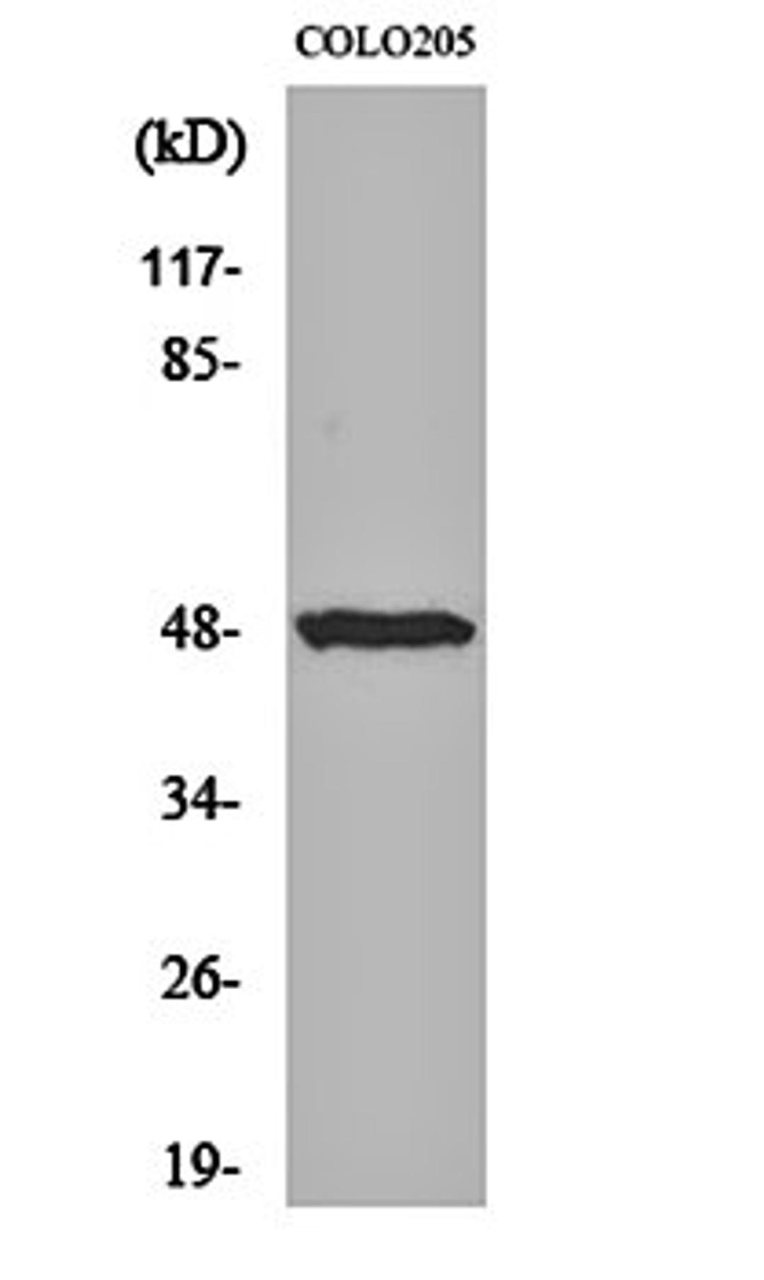 Western blot analysis of COLO205 cell lysates using IL-13R alpha1 antibody