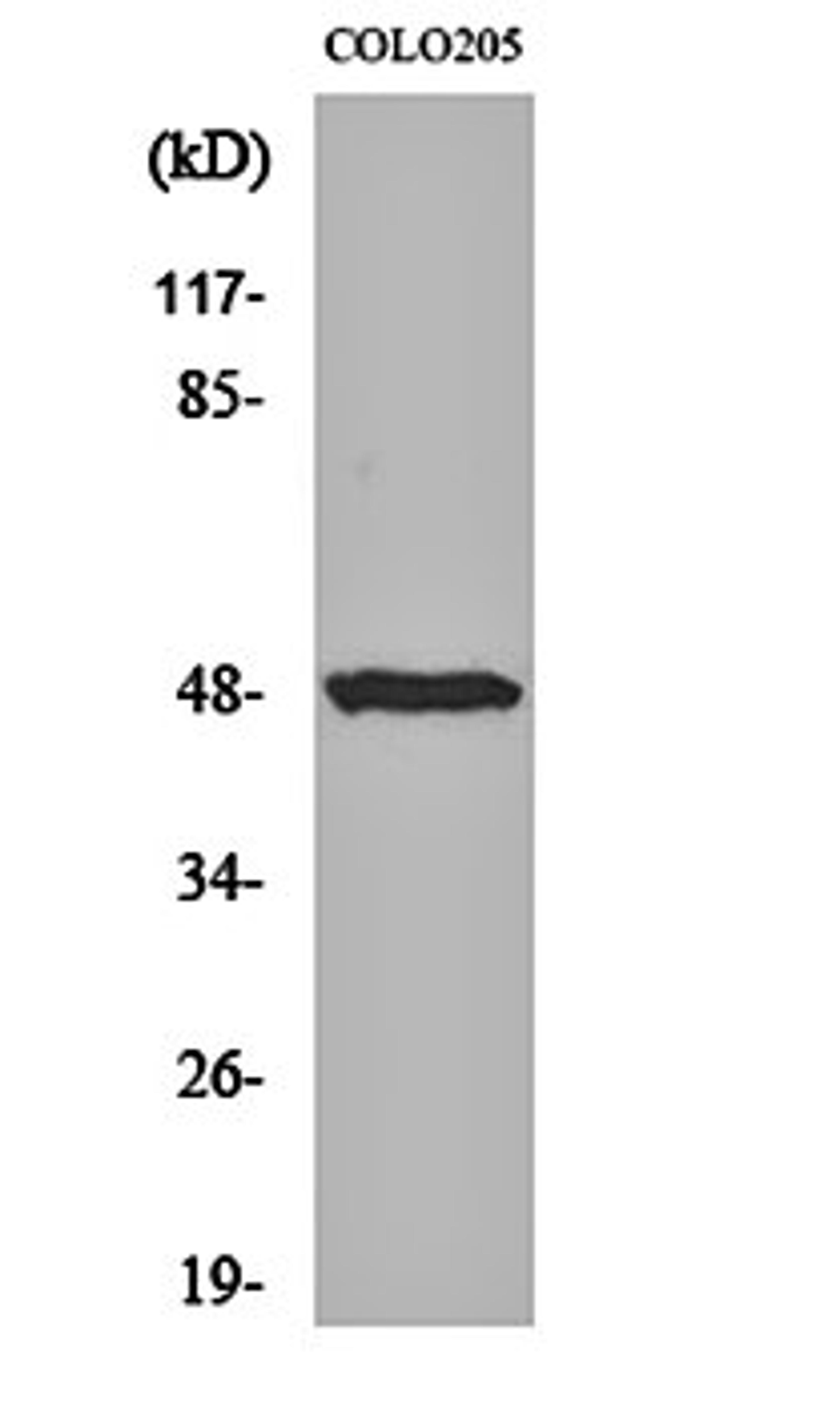 Western blot analysis of COLO205 cell lysates using IL-13R alpha1 antibody