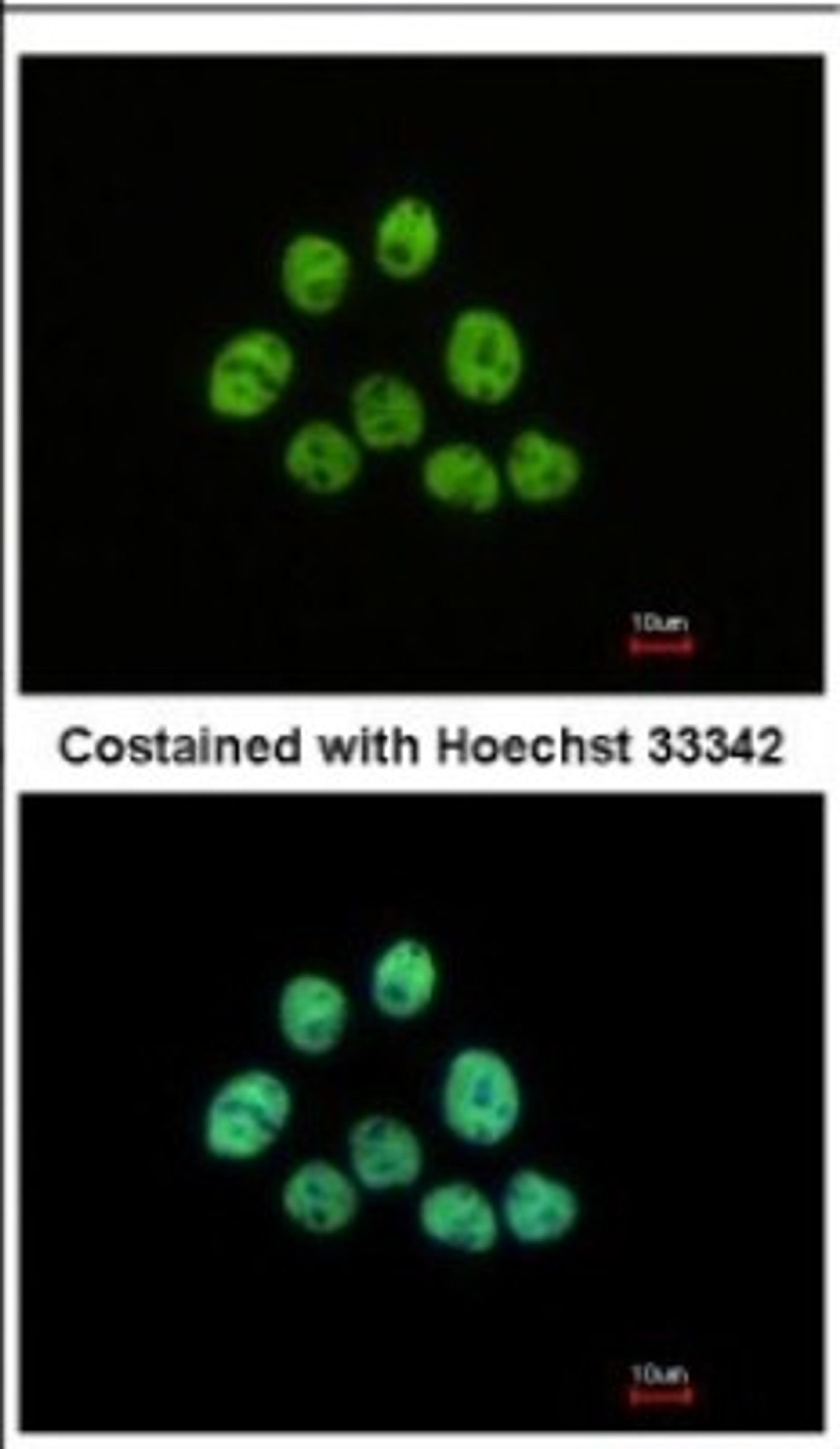 Immunocytochemistry/Immunofluorescence: HIST1H3A Antibody [NBP2-16838] - Immunofluorescence analysis of paraformaldehyde-fixed A431, using antibody at 1:500 dilution.