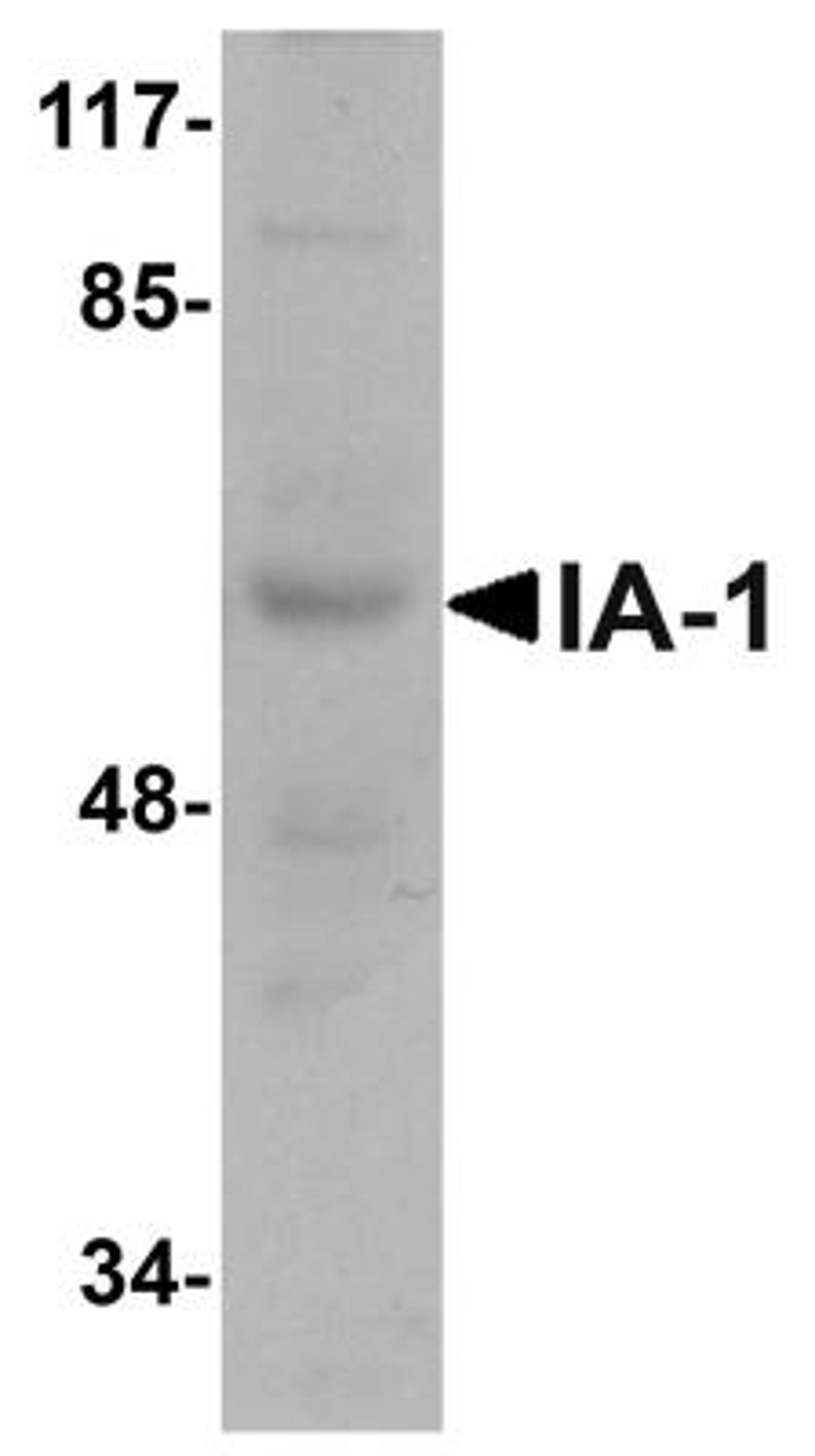 Western Blot: INSM1 Antibody [NBP1-76307] - Rat thymus tissue lysate with INSM1 antibody at 1 ug/mL.