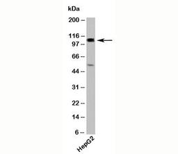 Western blot testing of human samples with CYLD antibody at 2ug/ml.