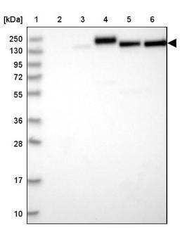 Western Blot: COL4A3 Antibody [NBP1-85836] - Lane 1: Marker [kDa] 250, 130, 95, 72, 55, 36, 28, 17, 10<br/>Lane 2: Human cell line RT-4<br/>Lane 3: Human cell line U-251MG sp<br/>Lane 4: Human plasma (IgG/HSA depleted)<br/>Lane 5: Human liver tissue<br/>Lane 6: Human tonsil tissue