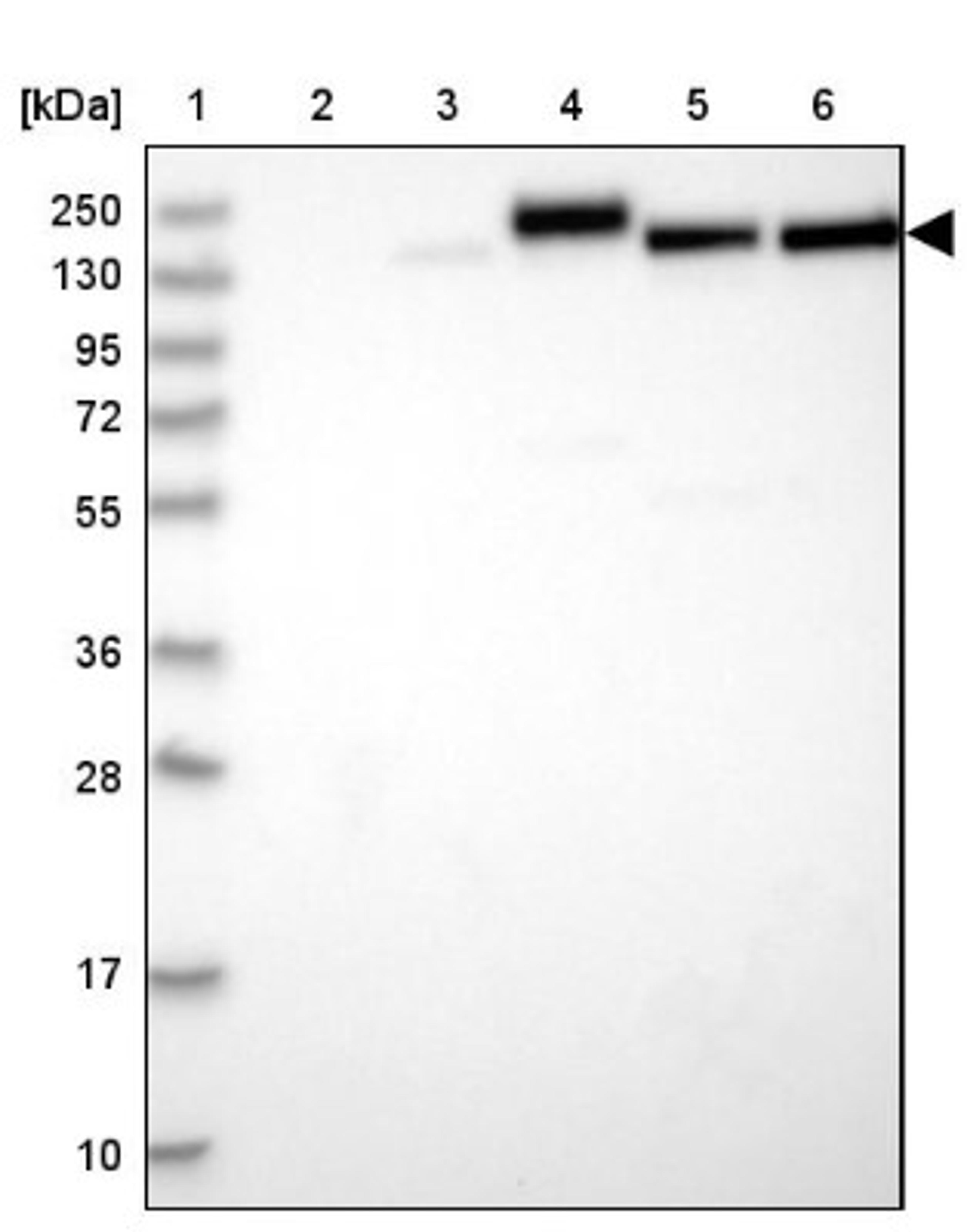 Western Blot: COL4A3 Antibody [NBP1-85836] - Lane 1: Marker [kDa] 250, 130, 95, 72, 55, 36, 28, 17, 10<br/>Lane 2: Human cell line RT-4<br/>Lane 3: Human cell line U-251MG sp<br/>Lane 4: Human plasma (IgG/HSA depleted)<br/>Lane 5: Human liver tissue<br/>Lane 6: Human tonsil tissue