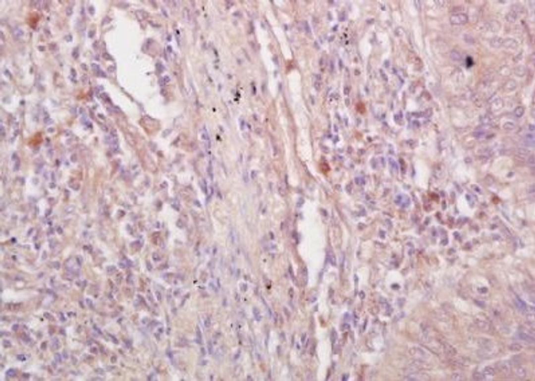 IHC-P image of human lung tissue using VE Cadherin antibody (dilution of primary antibody at 1:200)