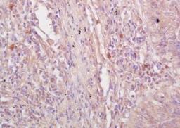 IHC-P image of human lung tissue using VE Cadherin antibody (dilution of primary antibody at 1:200)