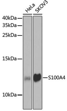 Western blot - FSP1/S100A4 antibody (A1631)