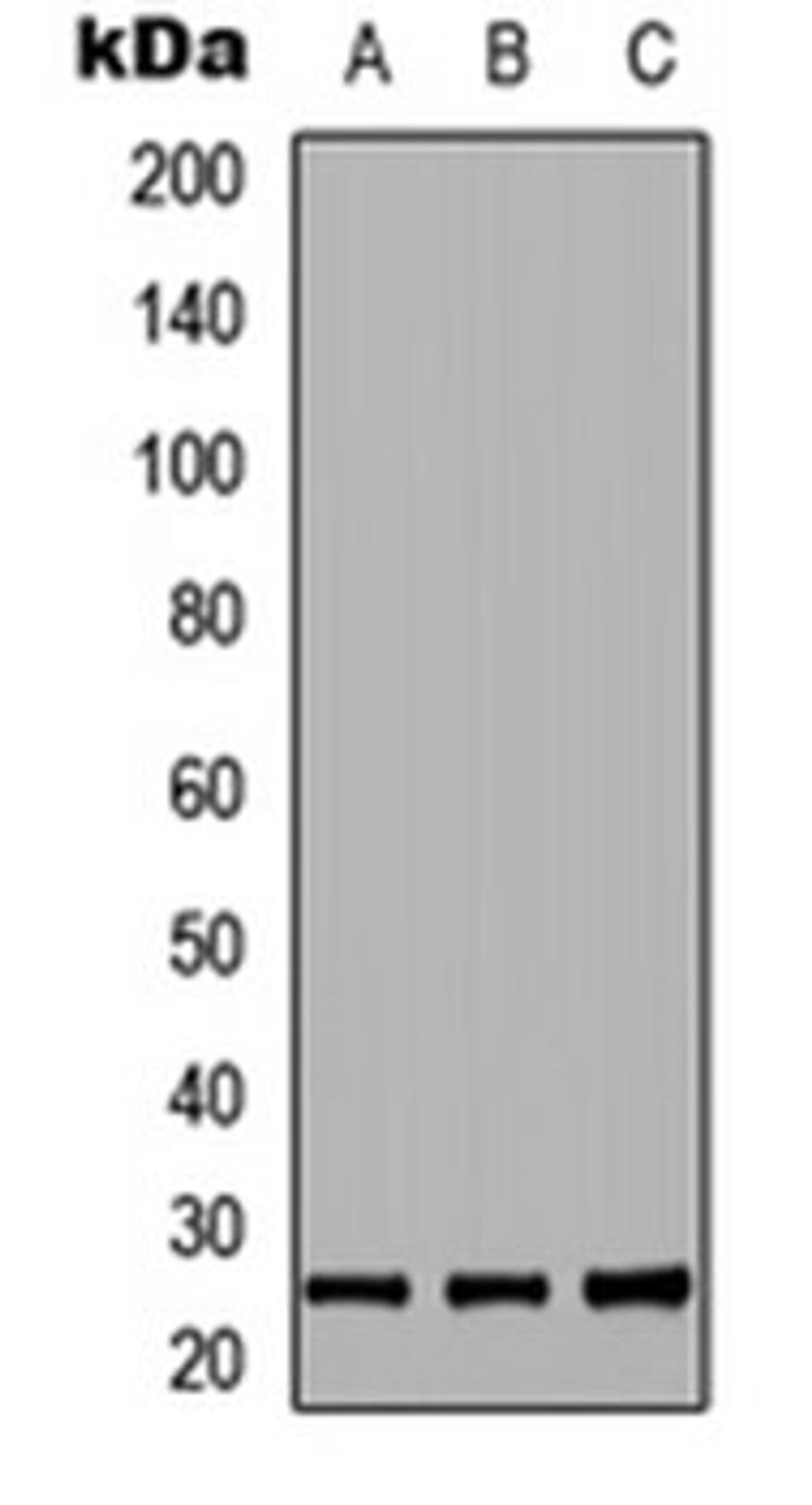 Western blot analysis of HEK293T (Lane 1), NS-1 (Lane 2), PC12 (Lane 3) whole cell lysates using RND2 antibody