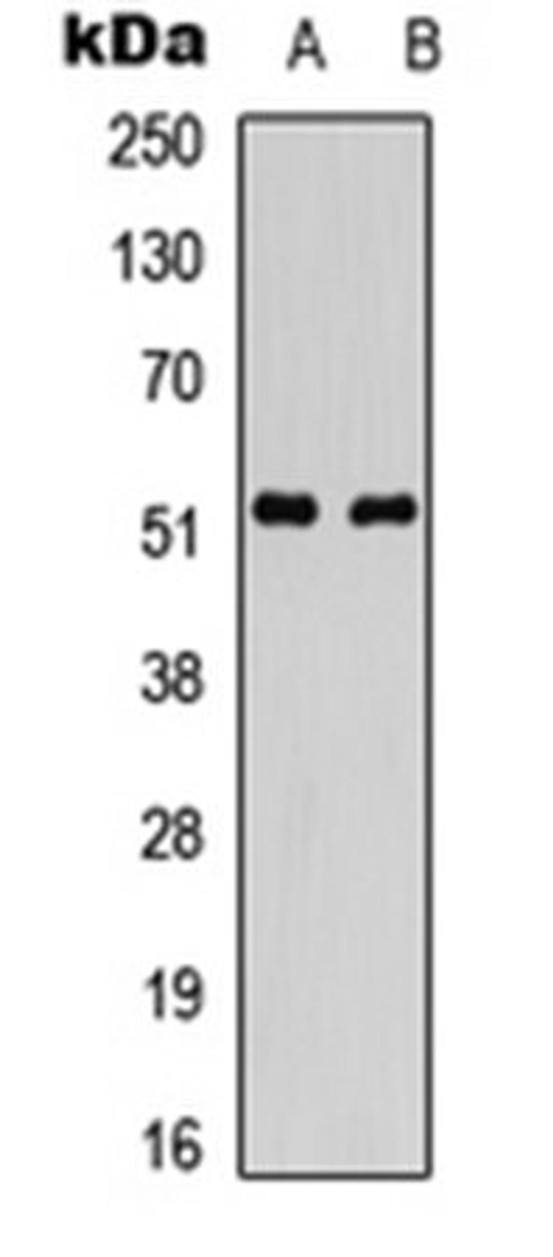 Western blot analysis of SHSY5Y (Lane 1), HuvEc (Lane 2) whole cell lysates using Parkin antibody